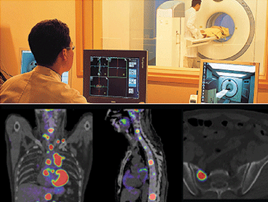 PET-CT